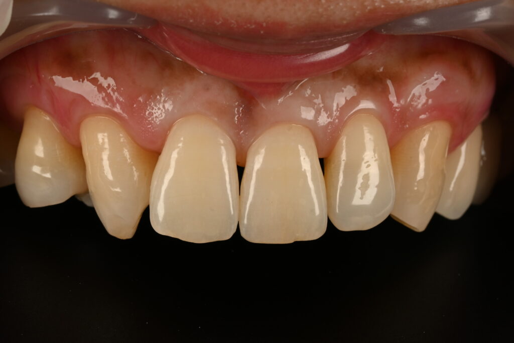 블랙트라이앵글