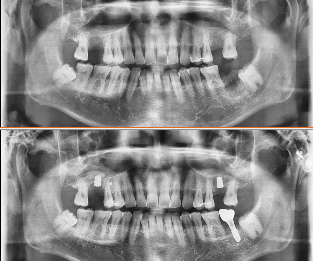 kakaotalk 20251101 133545241