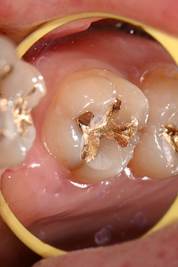 kakaotalk 20251106 000627728