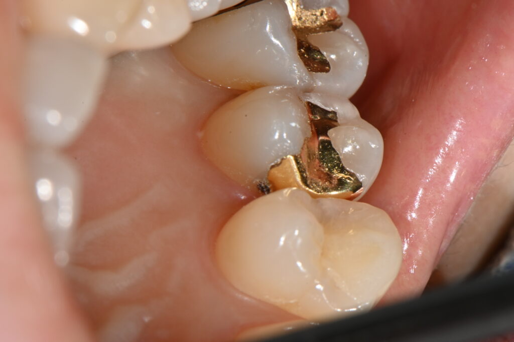 kakaotalk 20251106 000627728 01