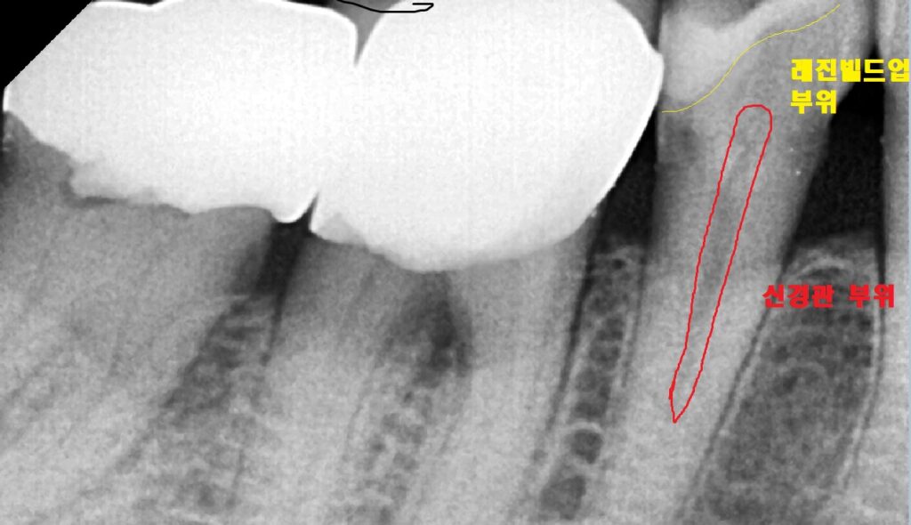 kakaotalk 20251113 003020365