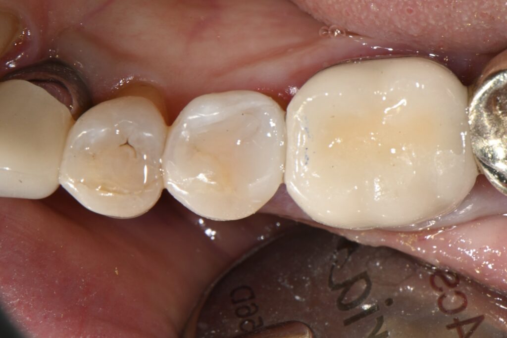 kakaotalk 20251113 003020365 01