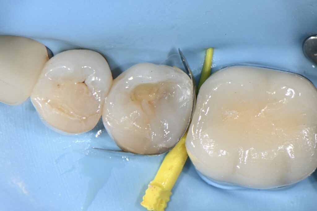 kakaotalk 20251113 003020365 03