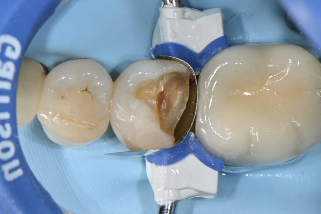 kakaotalk 20251113 003020365 04