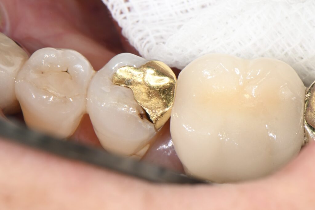 kakaotalk 20251113 003020365 07