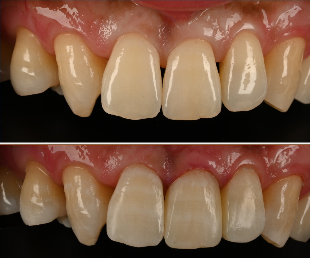 kakaotalk 20251116 020814194