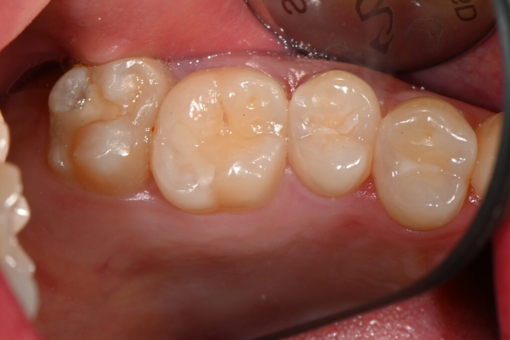 kakaotalk 20251128 001756979