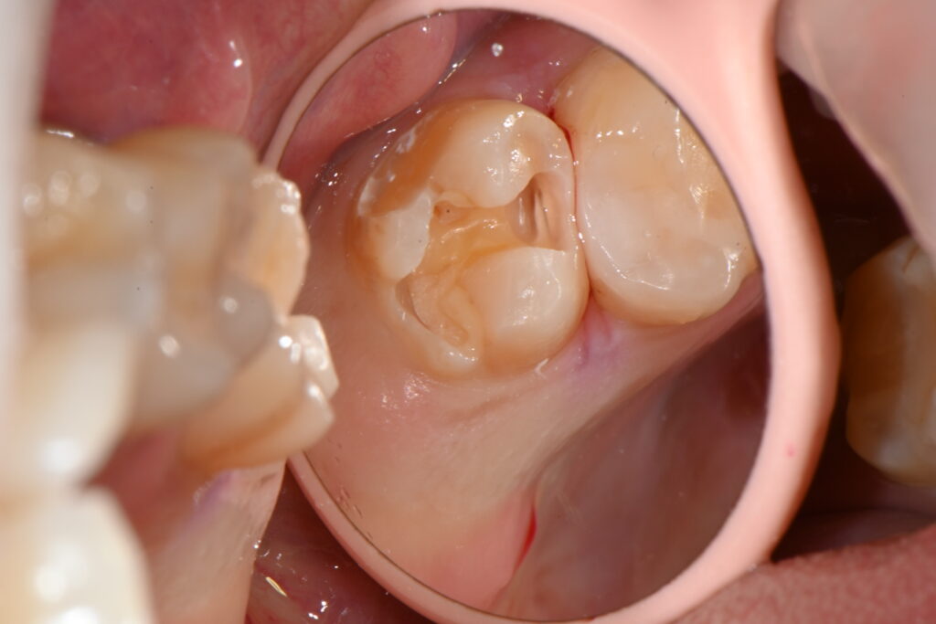 kakaotalk 20251128 001756979 01 (1)