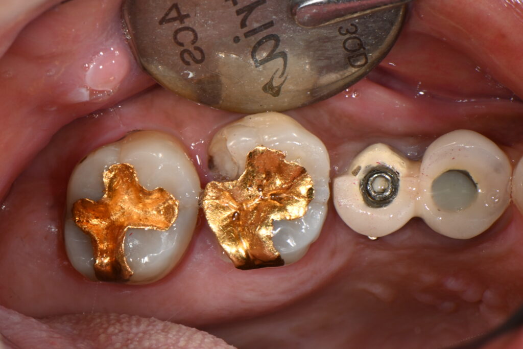 kakaotalk 20251128 003751469