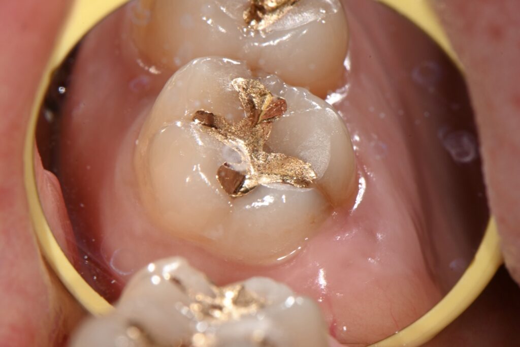 kakaotalk 20251128 003956867