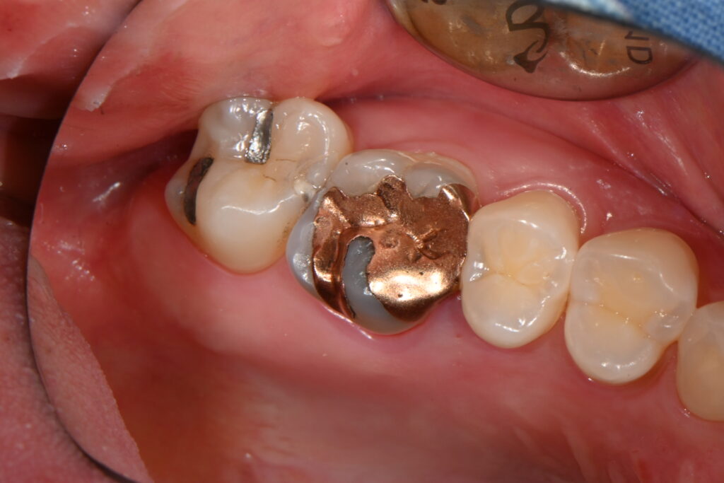 kakaotalk 20251128 004208556