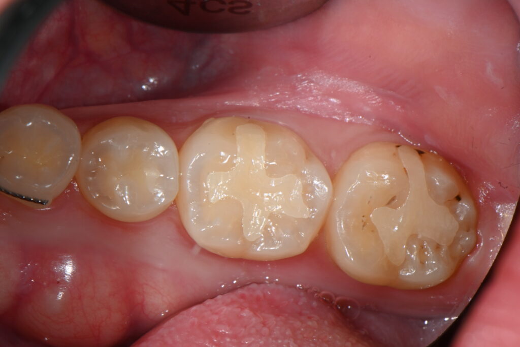 kakaotalk 20251128 004406012