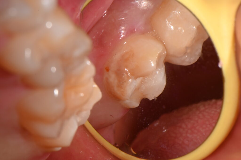 kakaotalk 20251128 005757466