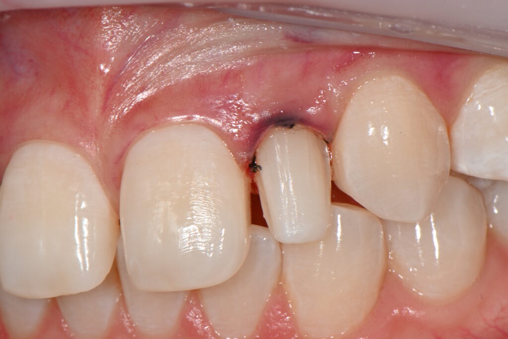 kakaotalk 20260223 003505395 01