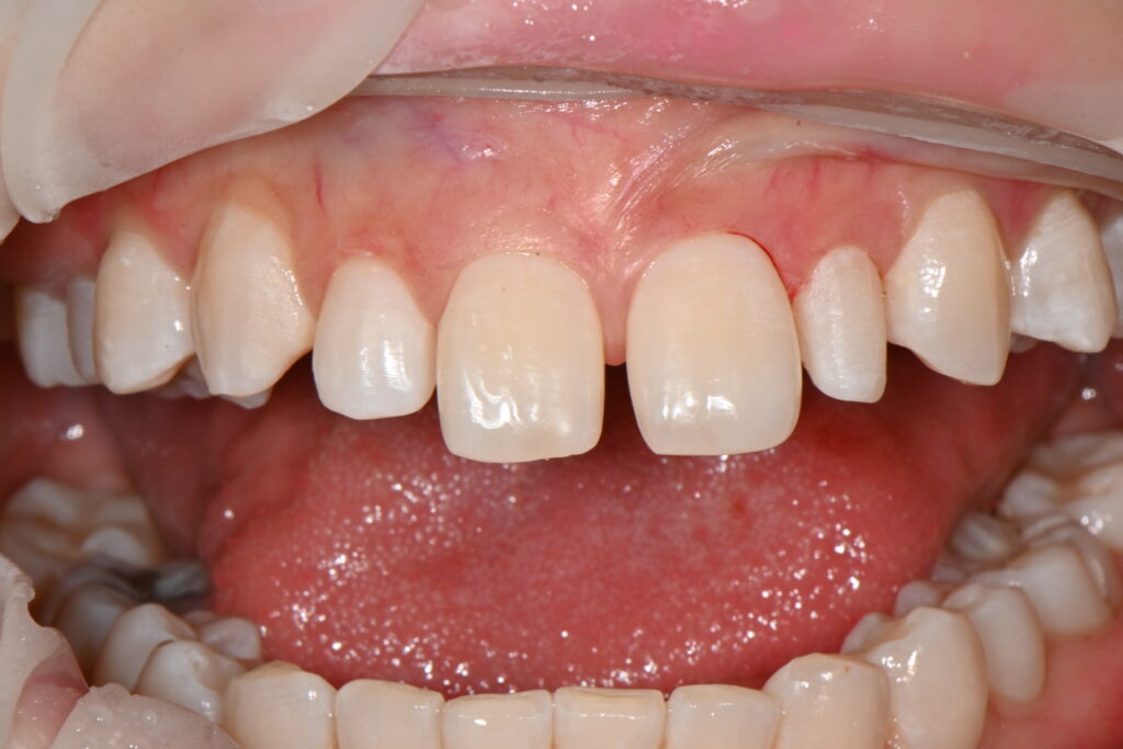 kakaotalk 20260223 003936411 12