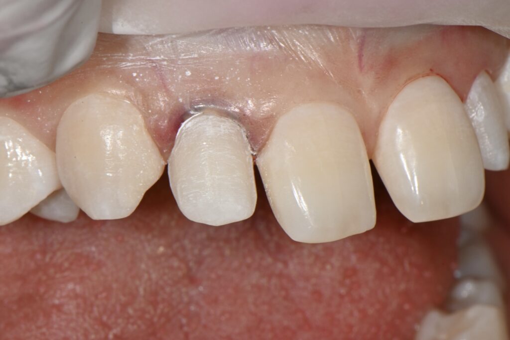 kakaotalk 20260223 003936411 15