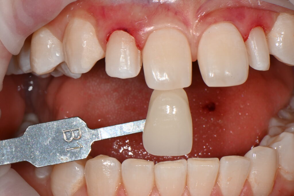 kakaotalk 20260223 003936411 21