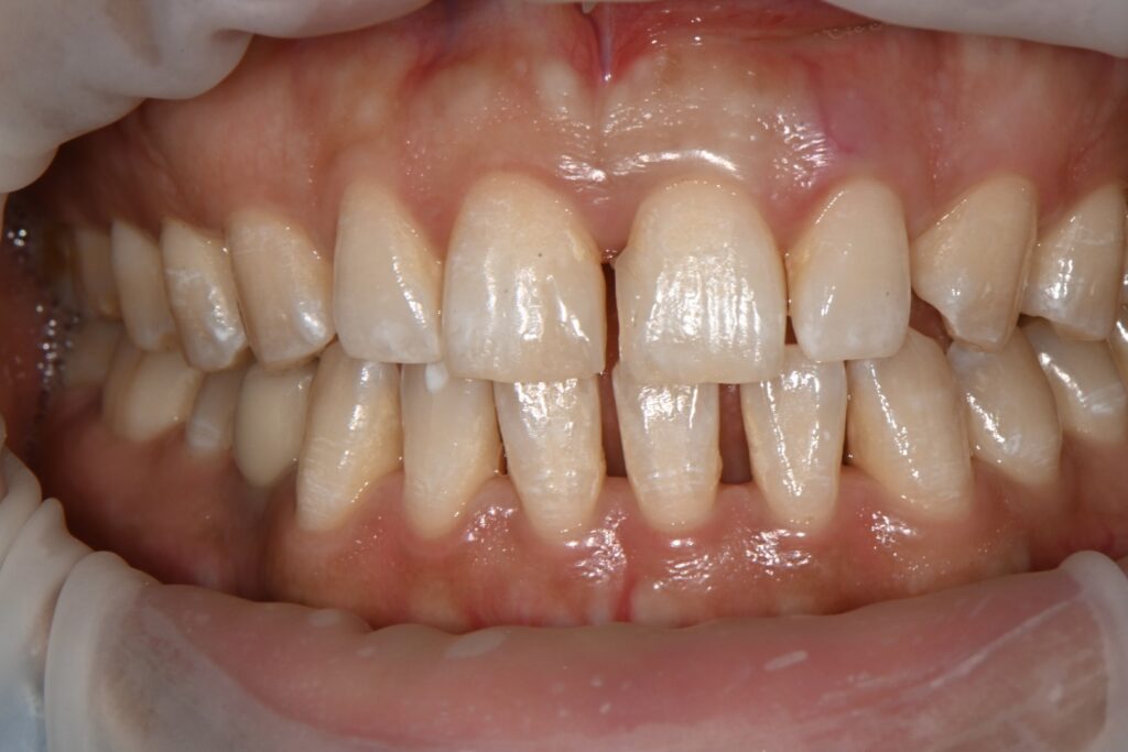 p20260221 111712200 e194a9c5 4011 4b9b 9301 835a54e941e9